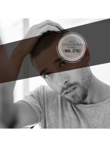 Bioxcin Genesis Yağlı Saçlar İçin Şampuan 300ml 3 Al 2 Öde - 2