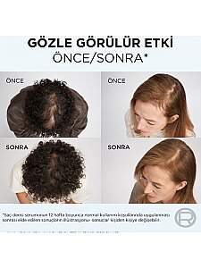 Elseve Growth Booster Dökülme Karşıtı 200 ml Şampuan - 5