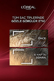 Elseve Komple Direnç Dökülme Karşıtı Saç Bakım Kremi 250 ml - 5