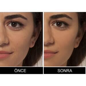 L'Oreal Paris True Match Kapatıcı 4N Beige - 4