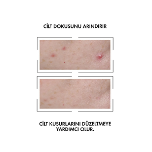 Vichy Normaderm Probio-BHA Leke Karşıtı Serum 30 ml - 2