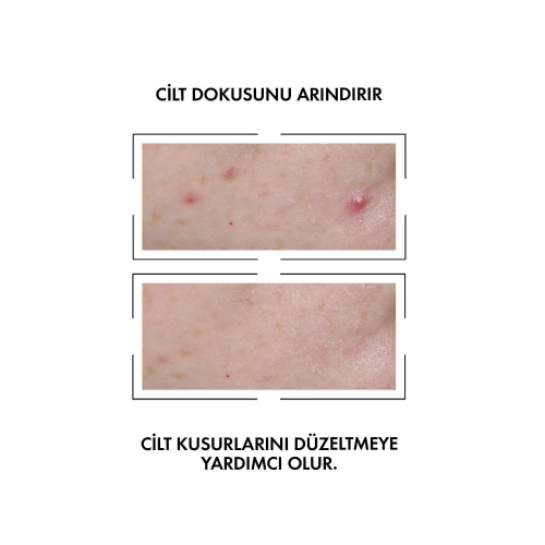Vichy Normaderm Probio-BHA Leke Karşıtı Serum 30 ml - 2
